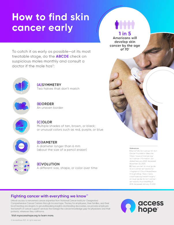 https://f.hubspotusercontent30.net/hubfs/8332333/Image%20Assets/HTA%20Landing%20Page/Skin%20cancer%20infographic.png