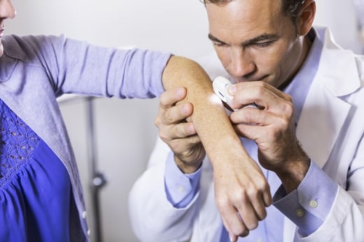 skin cancer featured image