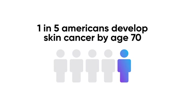 The basics of skin cancer prevention-thumb